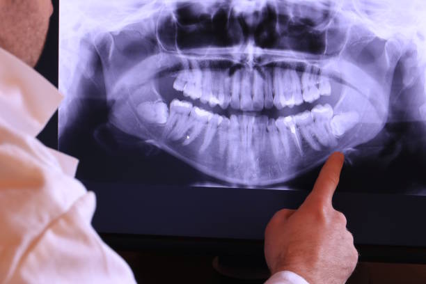 Best Broken Tooth Emergency  in Noroton, CT