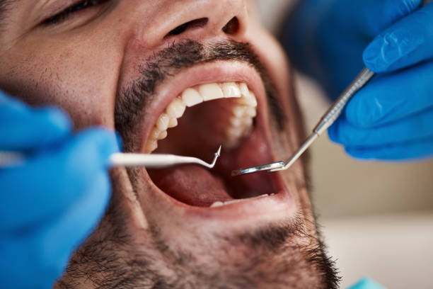 Best Tooth Infection Emergency Dentist  in Noroton, CT